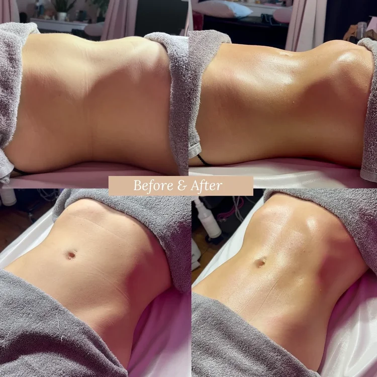 lymfedrænage massage